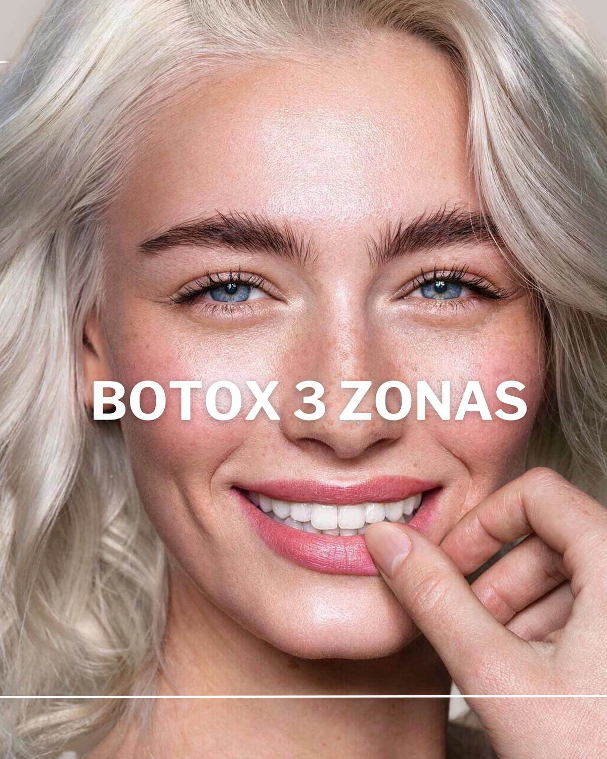 Botox Facial (3 zonas)